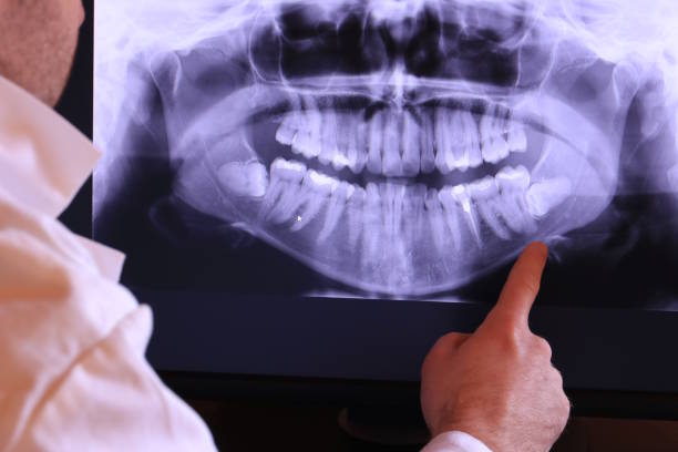 Best Emergency Treatment for Jaw Pain or Injury in Kingstree, SC