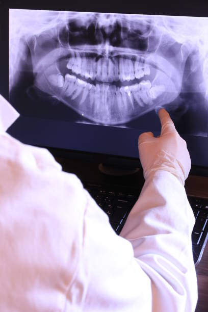 Best Emergency Wisdom Tooth Extraction in Kingstree, SC