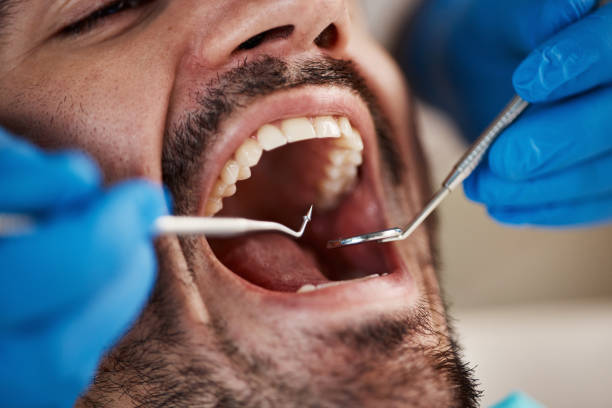 Best Emergency Dental Care for Sports Injuries in Kingstree, SC